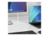 StarTech 6.6ft (2m) USB C to DisplayPort 1.2 Cable, Bidirectional - Close up